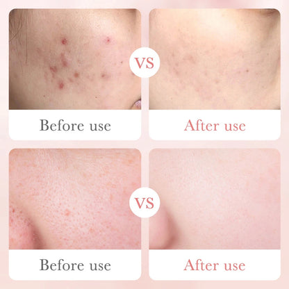 KIT ROSAS Y ACIDO HIALURONICO BIOAQUA CAJA DE LUJO